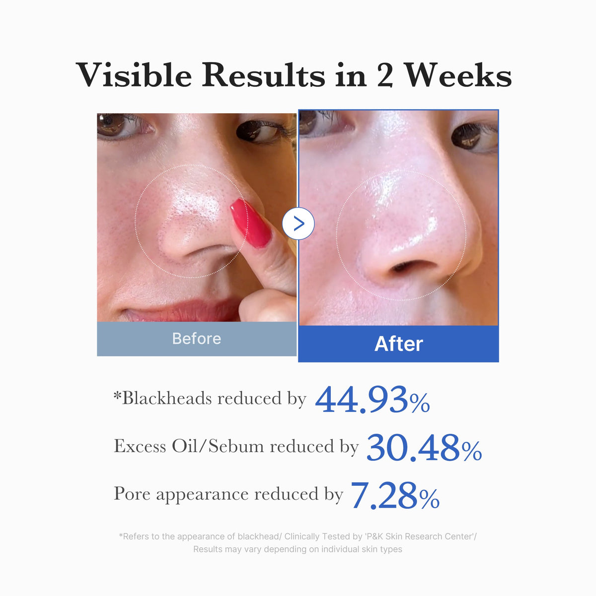 Zero Pore Pads | Medicube