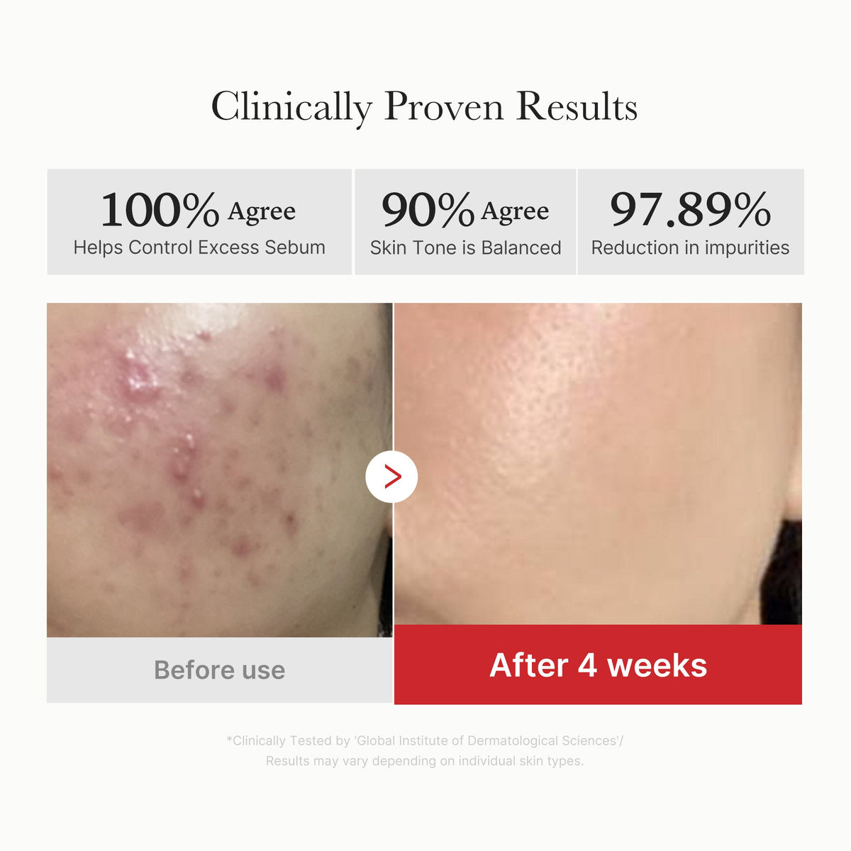 Red Succinic Acid Panthenol Pads | Medicube