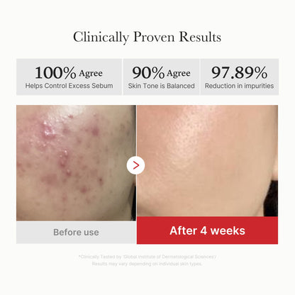 Red Succinic Acid Panthenol Pads | Medicube