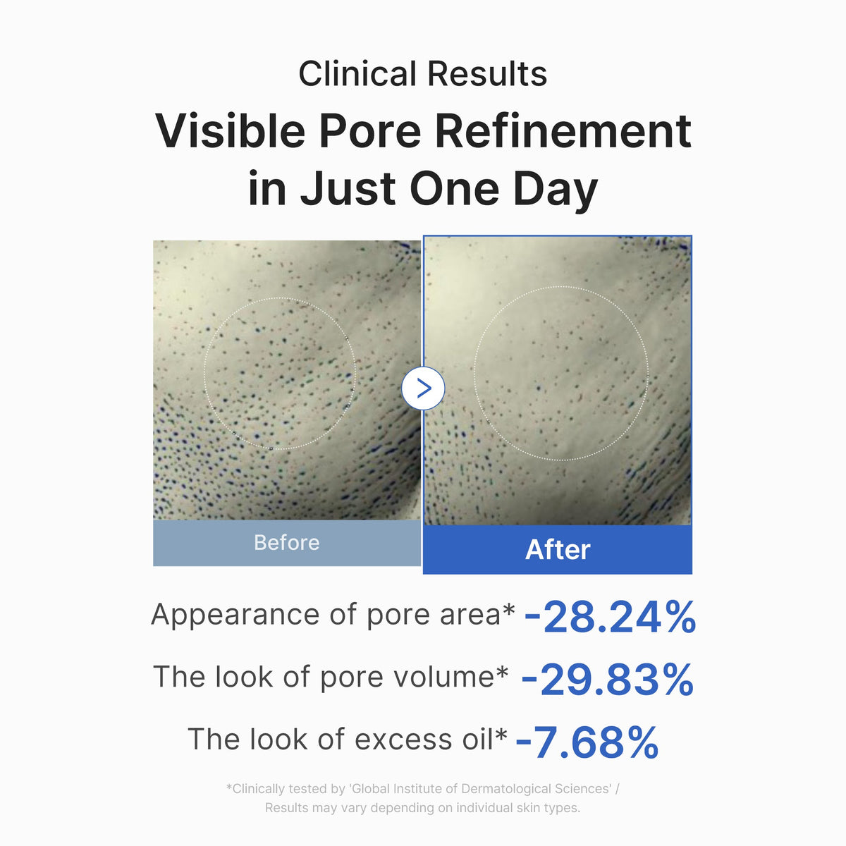 [Subscr.] Zero Pore One-day Peptide Serum | Medicube