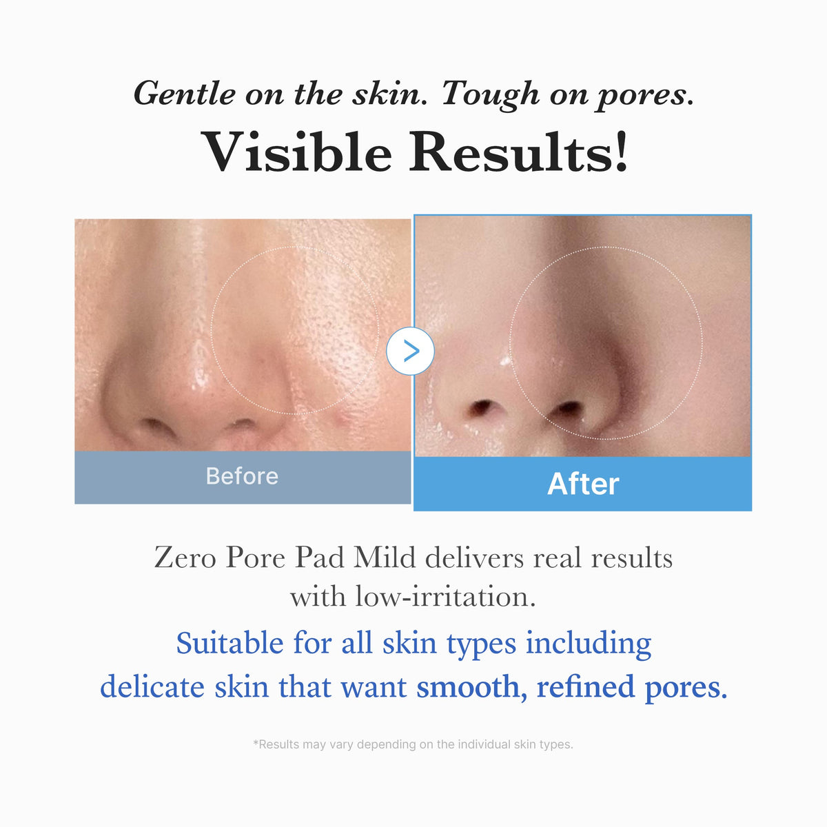 Zero Pore Madecassoside Pads (Mild) | Medicube