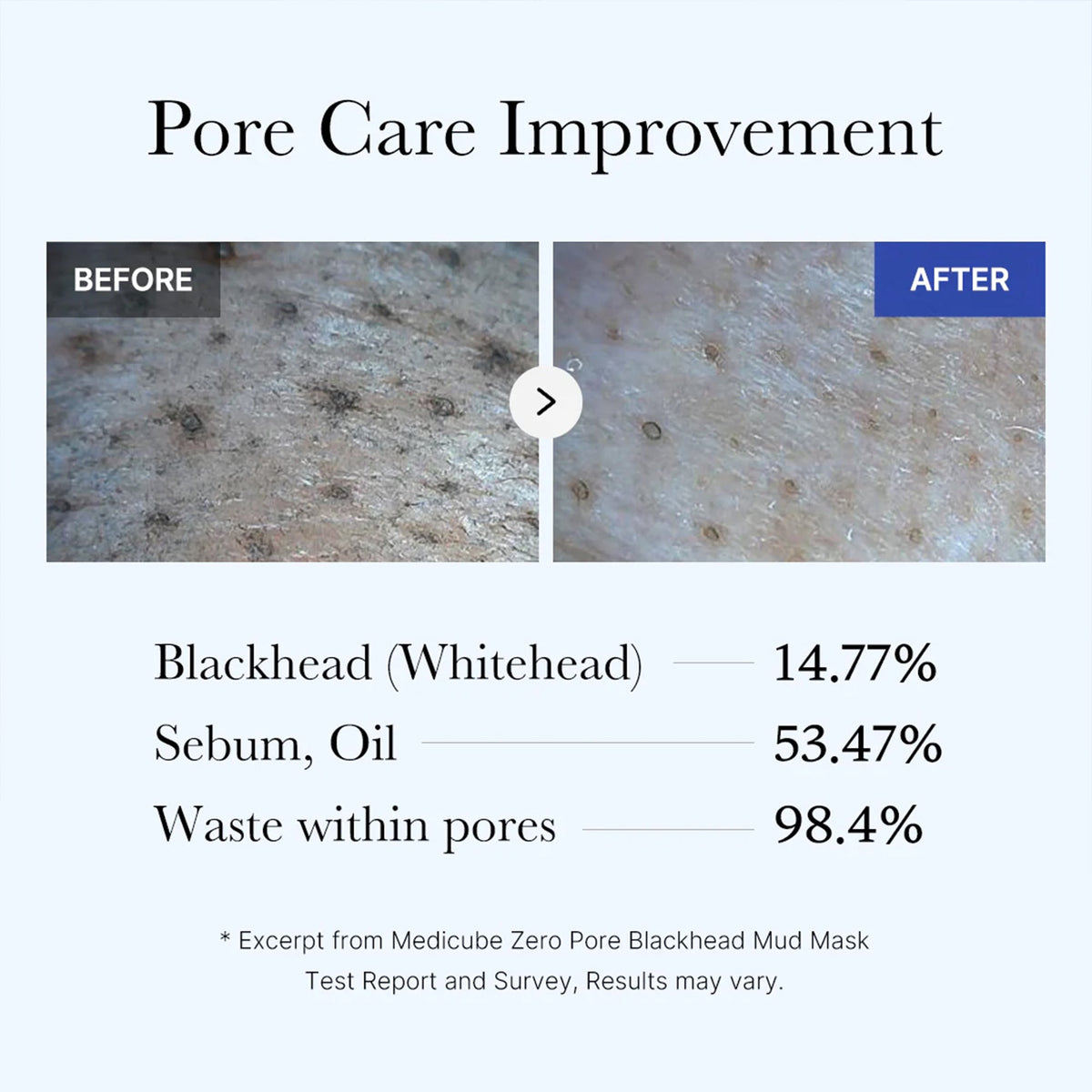 Zero Pore Blackhead Mud Mask | Medicube
