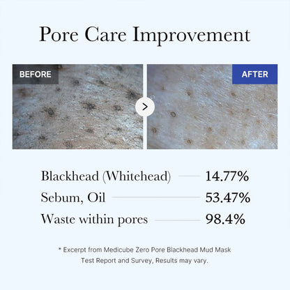 Zero Pore Blackhead Mud Mask | Medicube