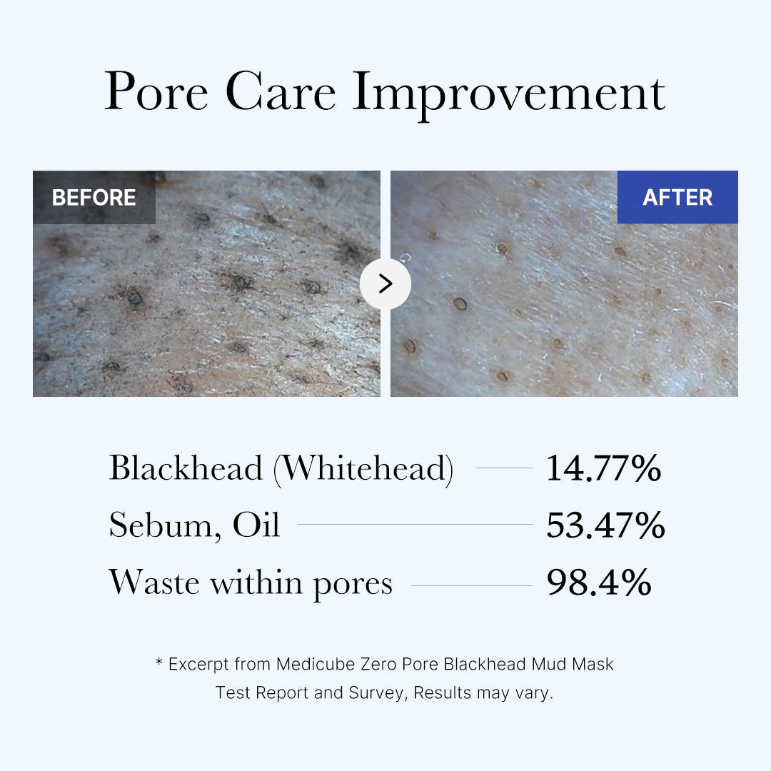 [Subscr.] Zero Pore Blackhead Mud Mask | Medicube