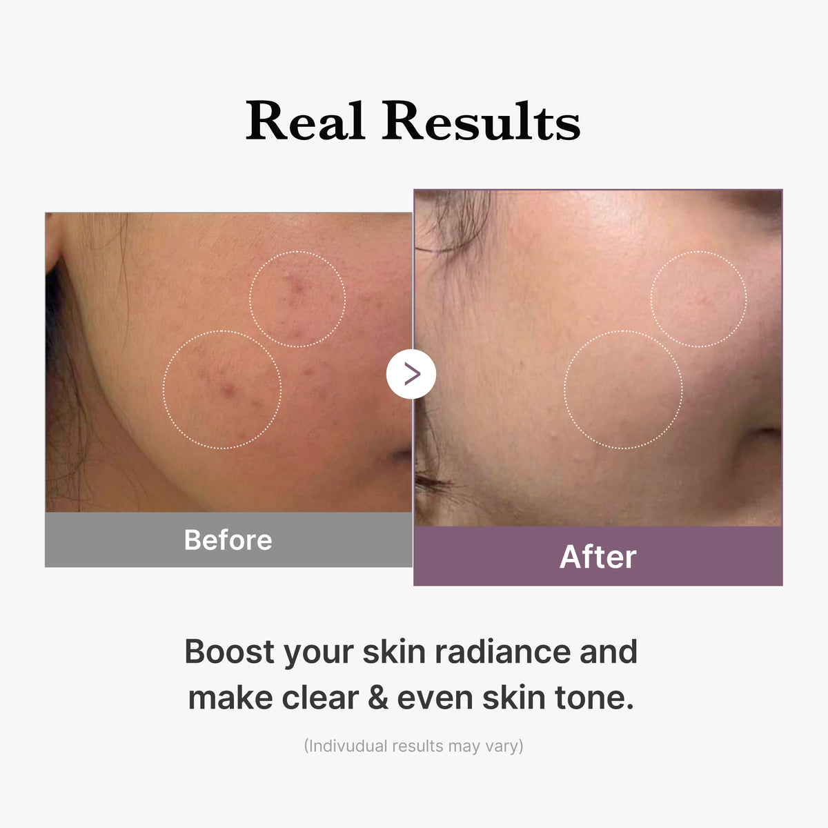AGE-R Glutathione Glow Milk Toner | Medicube