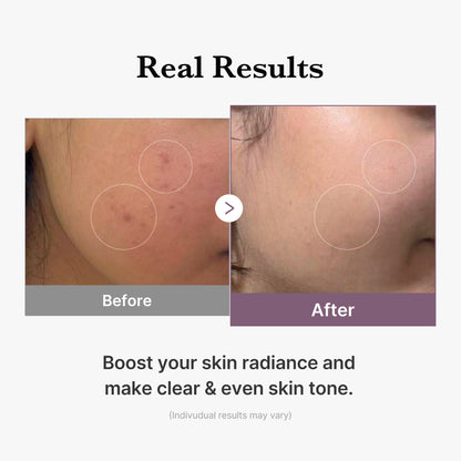 AGE-R Glutathione Glow Milk Toner | Medicube