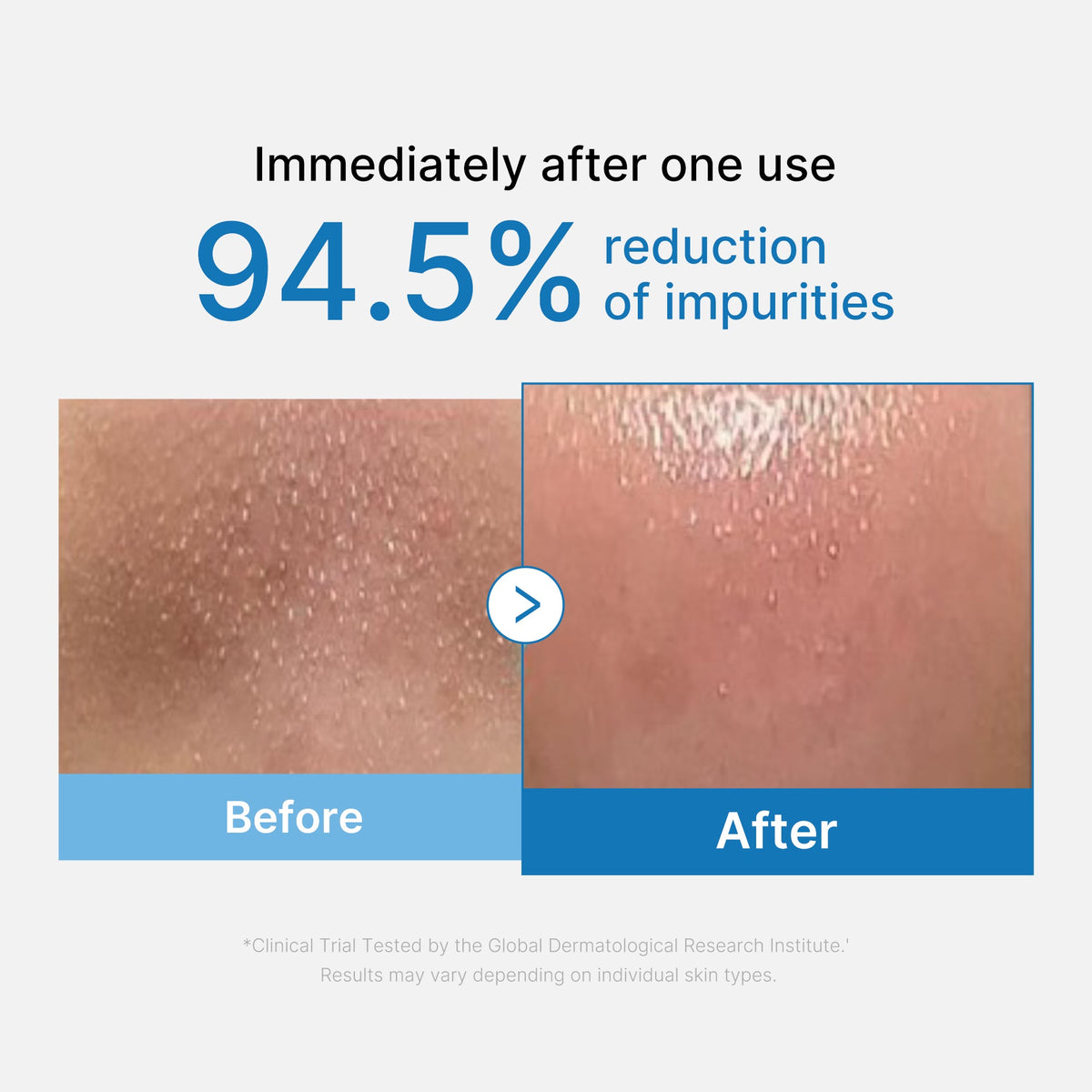 Zero Pore Blackhead Deep Cleansing Oil | Medicube