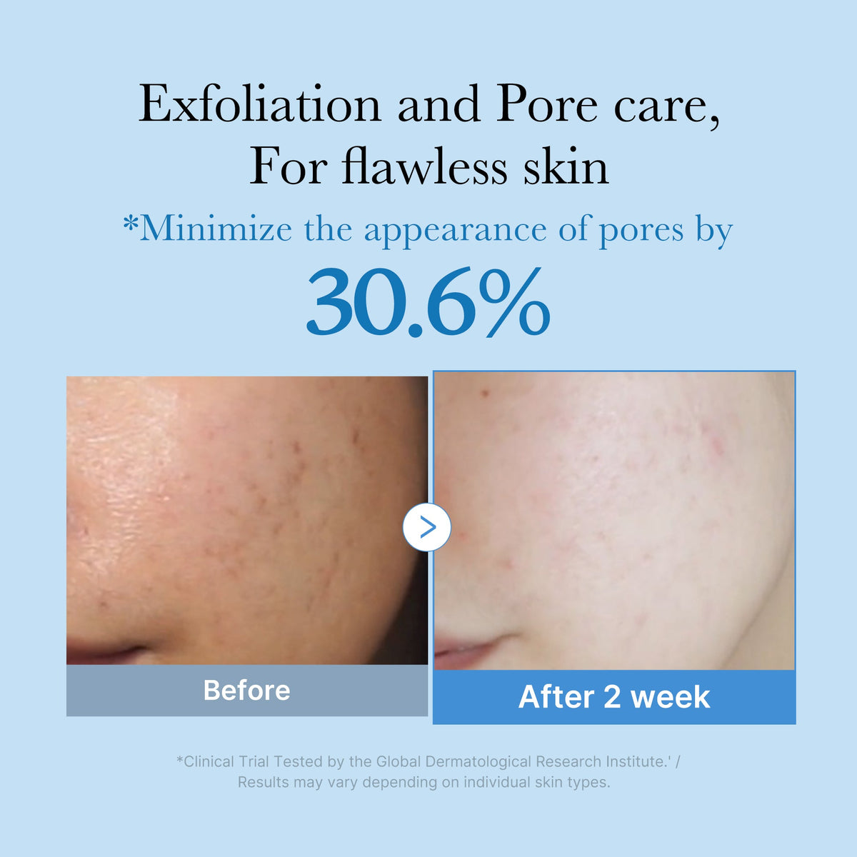 Zero Pore Toner | Medicube