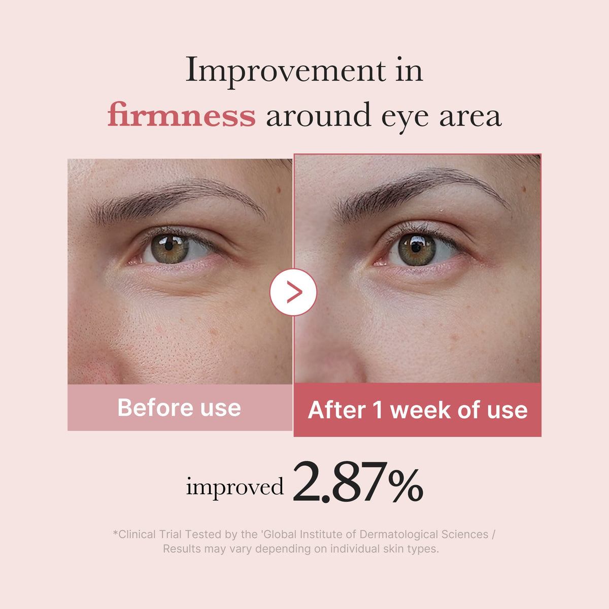 PDRN Pink Peptide Eye Cream | Medicube