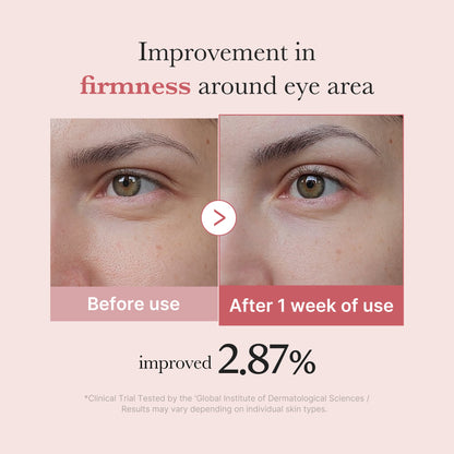 PDRN Pink Peptide Eye Cream | Medicube