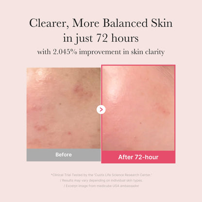 TXA Niacinamide Serum | Medicube