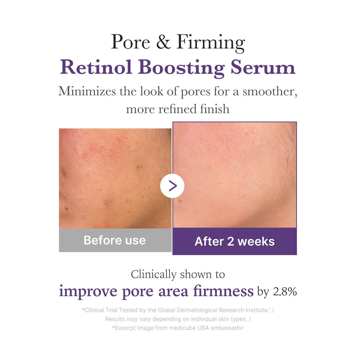 Retinol NMN Boosting Serum | Medicube