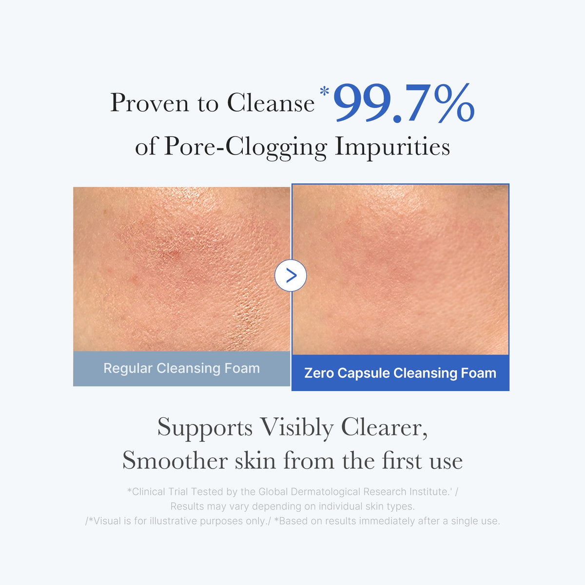 Zero Pore Capsule Cleansing Foam | Medicube
