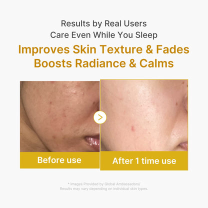 [Subscr.] Kojic Acid Turmeric Overnight Wrapping Mask | Medicube