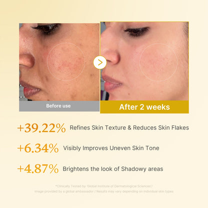 [Subscr.] Kojic Acid Turmeric Toner | Medicube