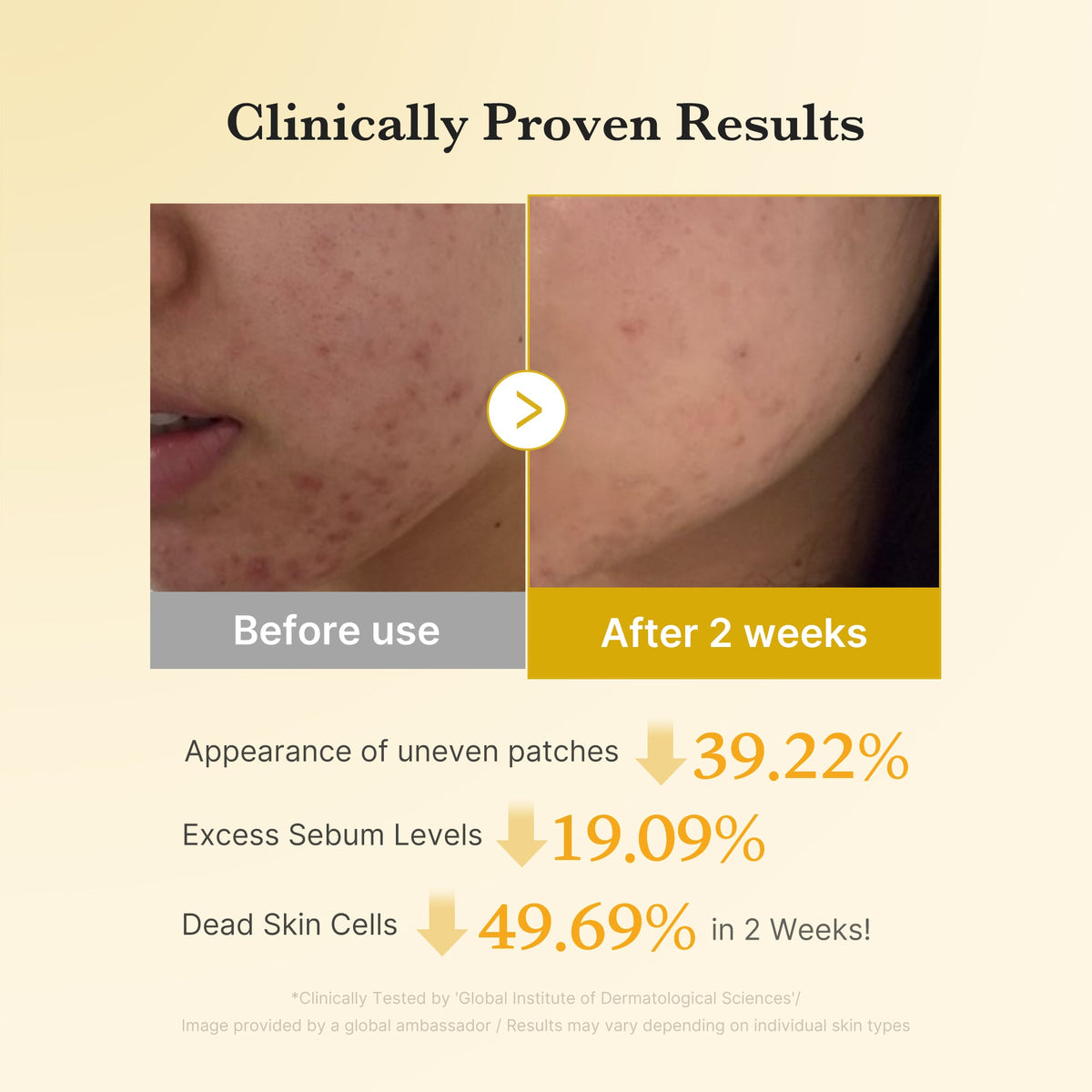 [Subscr.] Kojic Acid Tumeric Toner Pad | Medicube