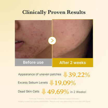 [Subscr.] Kojic Acid Tumeric Toner Pad | Medicube