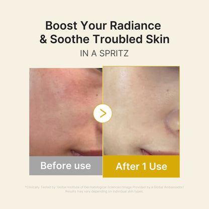 Kojic Acid Turmeric Vitamin Gold Jelly Mist Serum | Medicube
