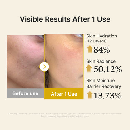 Kojic Acid Turmeric Vitamin Gold Jelly Mist Serum | Medicube