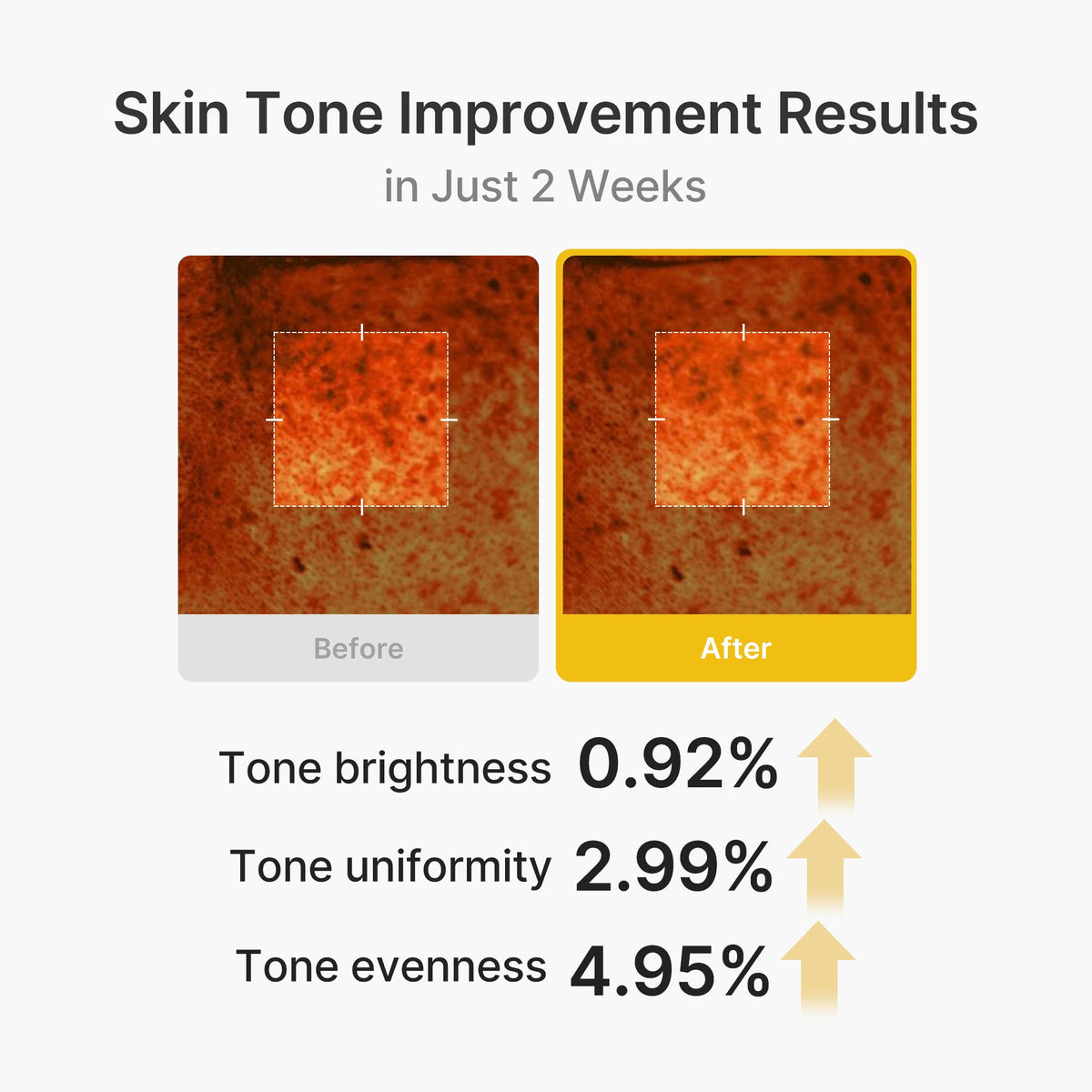 Kojic Acid Turmeric Vita Capsule Cream | Medicube