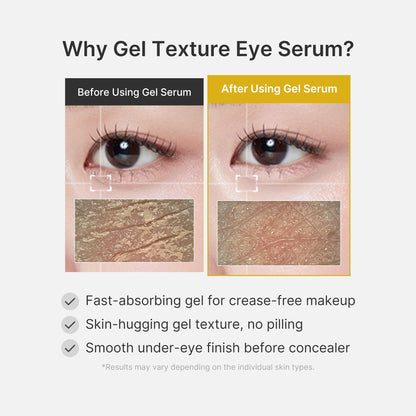 Kojic Acid Tumeric Eye Gel Serum | Medicube