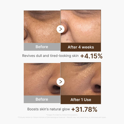 Deep Vitamin C Capsule Serum | Medicube