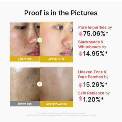 Kojic Acid Turmeric Peel Shot | Medicube