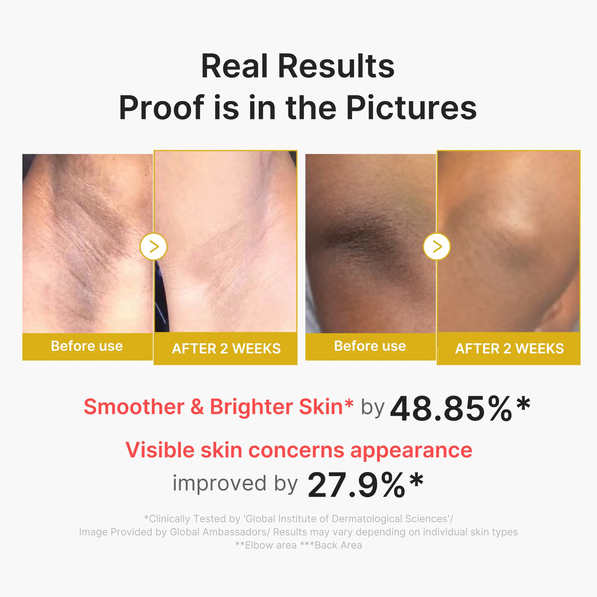 Kojic Acid Turmeric Body Peel Shot | Medicube