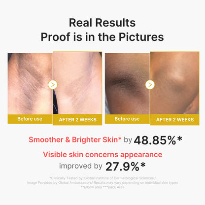 Kojic Acid Turmeric Body Peel Shot | Medicube