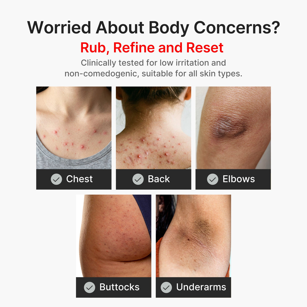 Kojic Acid Turmeric Body Peel Shot | Medicube