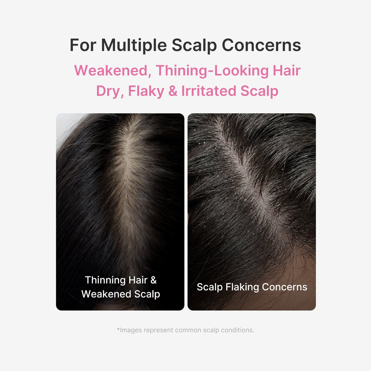 Rosemary PDRN Scalp Serum | Medicube