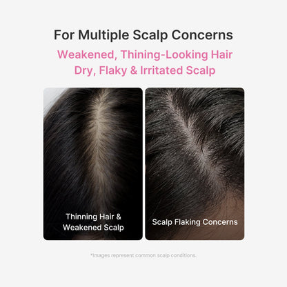 Rosemary PDRN Scalp Serum | Medicube